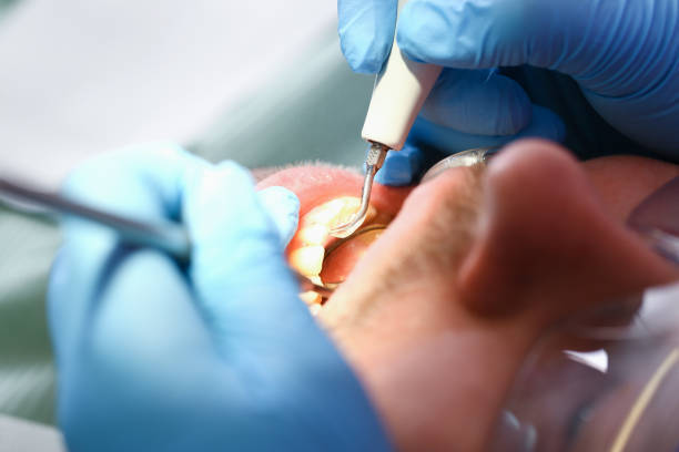 Best Tooth Infection Emergency Dentist  in Algona, WA