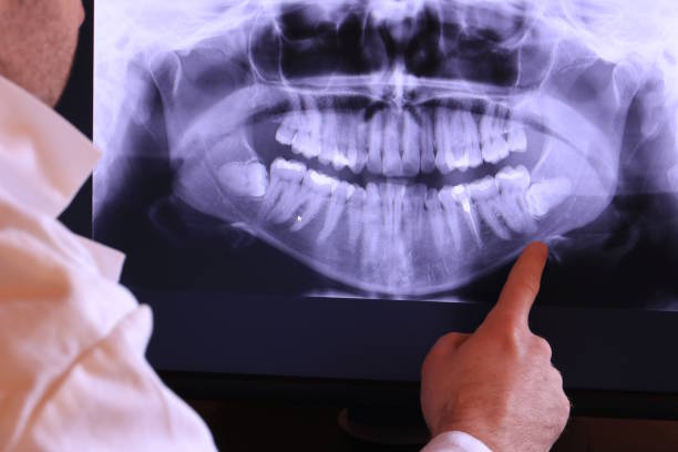 Best Knocked-Out Tooth Emergency  in Algona, WA