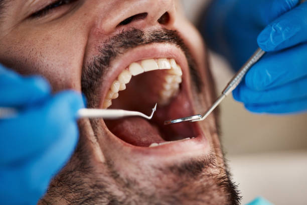 Best Dentist for Tooth Abscess  in Algona, WA