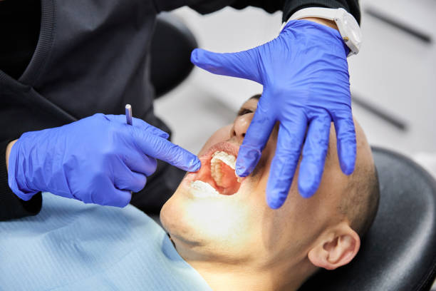 Best Emergency Tooth Extraction  in Algona, WA